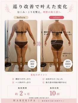 ハレキパ 鵠沼海岸(halekipa)/40代のお客様/肩こり・冷え改善