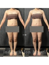 ヒヨリ(hiyori)/《before/after》body