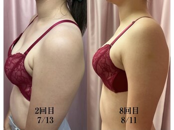 ビウラ(BIURA)/【20代】8回コース