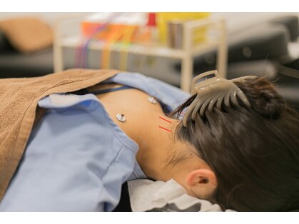 ゼロスポ鍼灸 整骨院 篠崎の写真