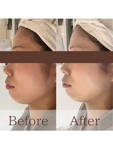 凪眠/小顔リンパフェイシャルの効果71