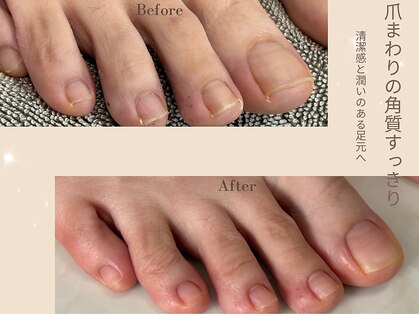 ピンナ(PINNA)の写真