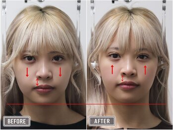 さつま骨格矯正 表参道青山院/歪み小顔矯正＋骨盤矯正