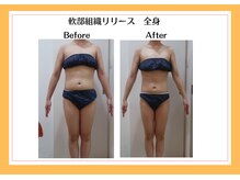 リヴェーヌ 富山店/骨盤矯正もお任せください！