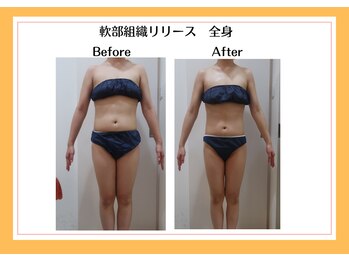 リヴェーヌ 富山店/骨盤矯正もお任せください！