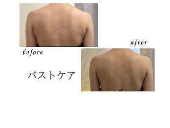 リリー(Lily)/バスト