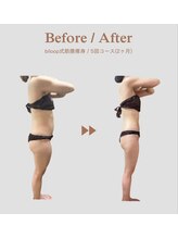 ビループ(biloop)/圧倒的、厚みの変化。