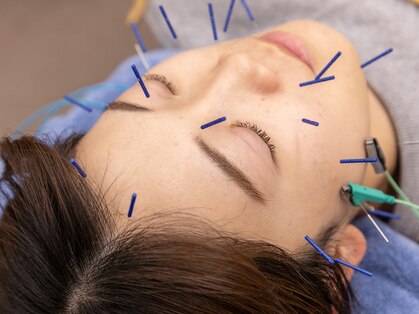 安心堂幕張接骨院 鍼灸院の写真