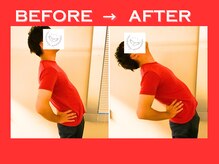 こころ整骨院/30代男性のビフォーアフター