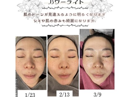 ラジェニアテンアンズ(Rajeunir 10 ans)の写真