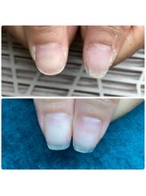 サラ(Sarah.)/おススメ深爪メニュー☆