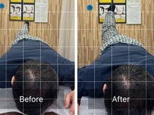 ナオル整体 札幌院(NAORU整体)/札幌円山/整体/姿勢矯正/猫背