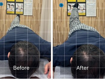 ナオル整体 札幌院(NAORU整体)/札幌円山/整体/姿勢矯正/猫背