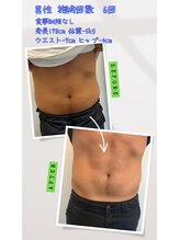 やお駅前鍼灸接骨院/電磁パルス痩身マシン