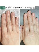 桃の木 吉祥寺店/爪の形は変わります♪6ヶ月経過