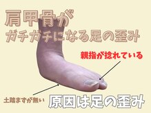 ニコ(niko)/猫背も足の歪みが原因です