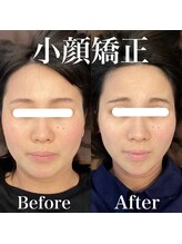 整体院ユールーム 下松店(YOUROOM)/【小顔矯正】