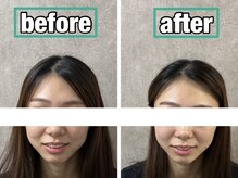 ボニー(Bonnie)/【小顔矯正＋リンパマッサージ】