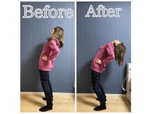 椿(tsubaki)の雰囲気（50代　女性　年に1回キックリ腰される方癖付いた腰痛を治したい）