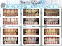 ホワイトニングショップ 宇治店