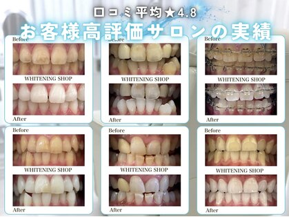 ホワイトニングショップ 宇治店の写真
