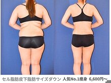 ピュアノア 垂水店/痩身ダイエット　神戸垂水明石