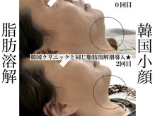 リベルキョウト 京都駅前店(Liber Kyoto)/レモンボトル超え!二重顎撃退