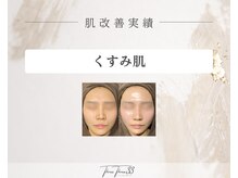 スリースリー 恵比寿(THREE THREE)/くすみ肌ケア 改善実績写真