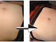 ダイエット アンド ビューティー アーシャ(Diet & Beauty Aasha)/ビーナスボディ施術例