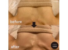 ビューティースリムケア メイシェン/バストケア