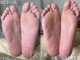 ベベ(Bebe)の写真/【韓国式美容で新感覚の角質ケア◎】角質が溜まりやすい男性のガサガサ足裏も徹底ケア☆[札幌/大通]