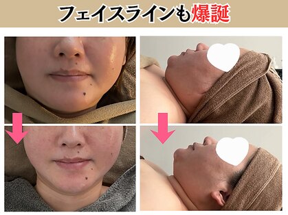 ヘッテ(Hette)の写真