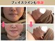 ヘッテ(Hette)の写真
