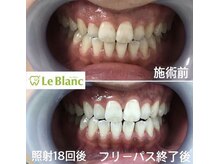 ルブラン 奈良店(Le Blanc)/歯であなたの印象が変わるかも？