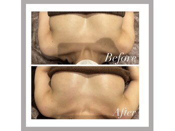 オークツリー(oak tree)/ぷるんぷるんバストケア