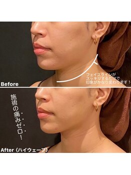 ミエル 神戸店(Miel)/HIRFWAVEハイアールエフウェーブ