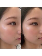 木6(キロク)/ラッシュリフト★