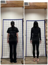 キズキ 高宮店(KIZUKI)/ダイエットコース　ビフォアフ