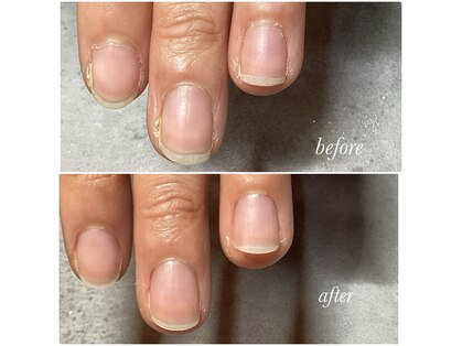 アモーレ プラス トゥエンティフォー(Amore +24)の写真