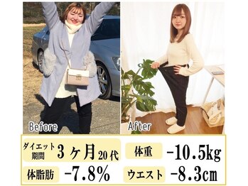 リラ(Lilas)/【ビフォアフ2】