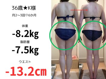 カブール 町田店/お尻痩せにもインドエステ！