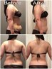 ★セル脂肪ケア人気No.1★固い筋肉、脂肪に温熱ハイパーナイフ90分¥38500→