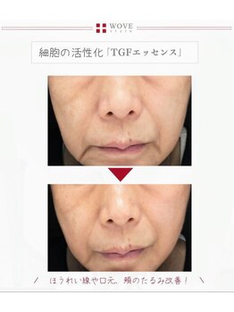 サロンドゥレーヴシエル(Salon de reve Ciel...)/【WOVEstyle】トリートメント