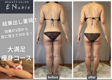 エネイブル(ENable)