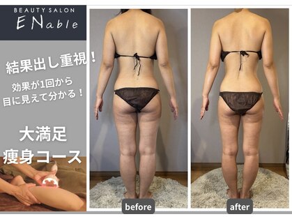 エネイブル(ENable)の写真