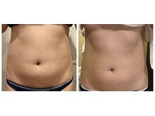 プリマヴェーラ(PRIMAVERA)/お腹