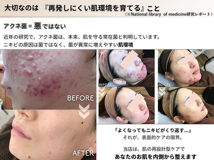 ビアンカの写真