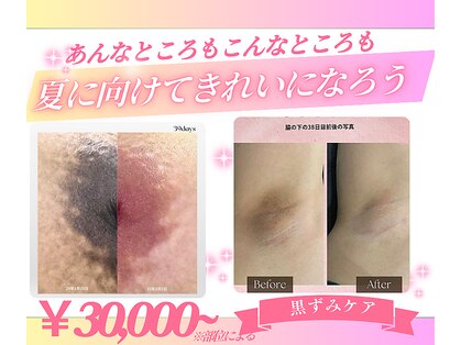 モア(more.)の写真