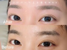フォルミー(forume)/同時施術でお目元アップデート！