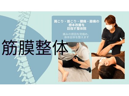 マ シアロンの写真
